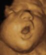 Baby05.jpg